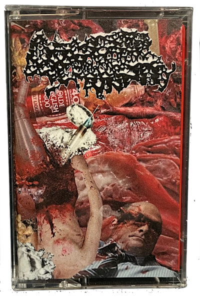 Domestic Immunity "S/T" Cassette